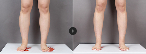 365mc BEFORE & AFTER