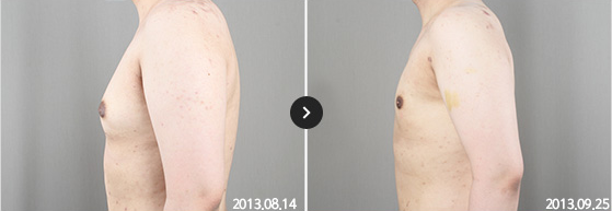 365mc BEFORE & AFTER