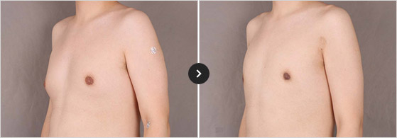365mc BEFORE & AFTER